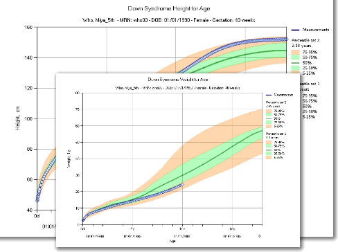 Down Syndrome Growth Charts